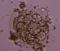 8-cell Grade IV